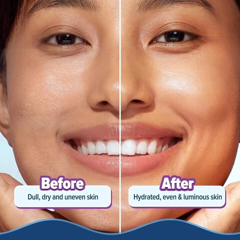 Aqualogica Illuminate Hydra Gel Moisturizer with Wild Berries Alpha Arbutin 200g