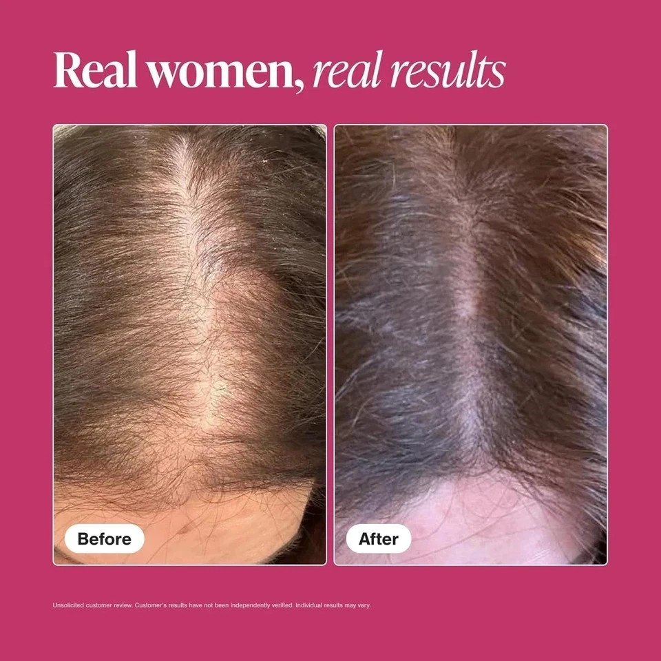 Viviscal Professional Hair Supplement Growth Tablets for Women 180 EXP 07 2027