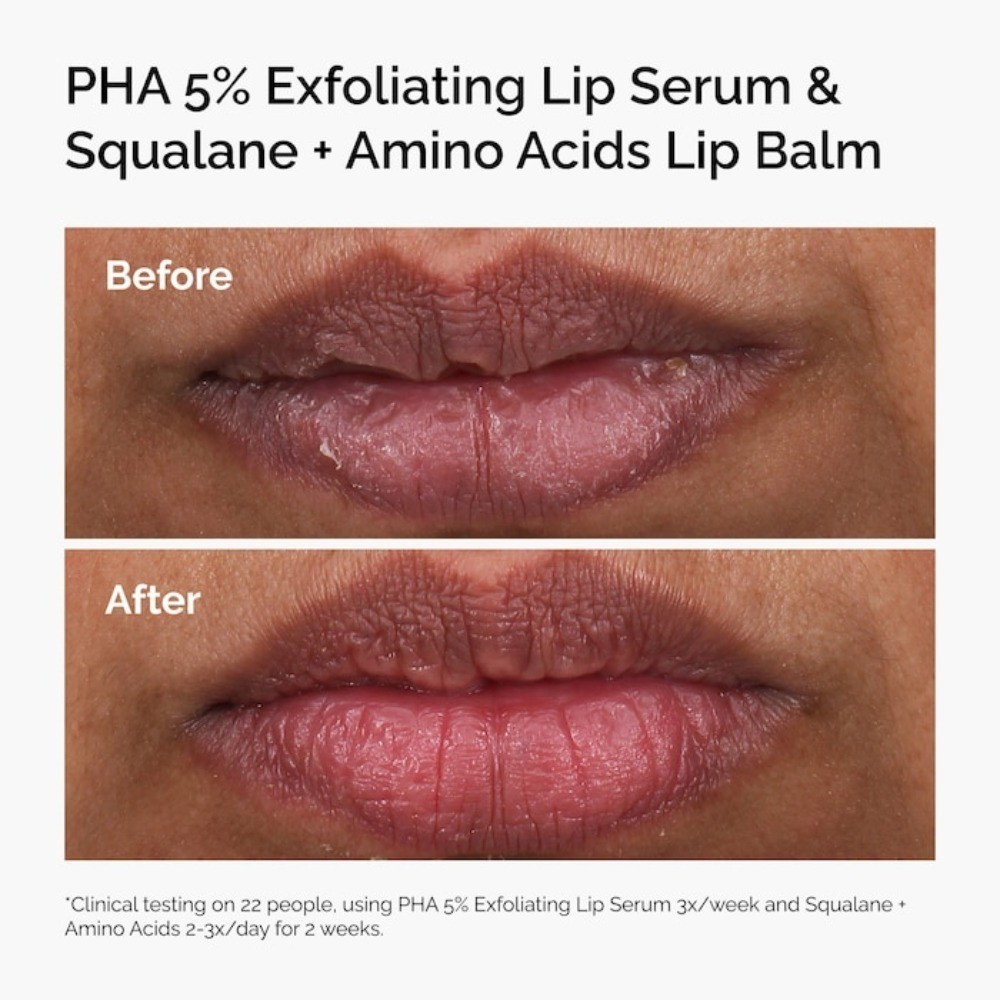 The Ordinary Authentic PHA 5% Exfoliating Lip Serum 0.5 oz/15 ml