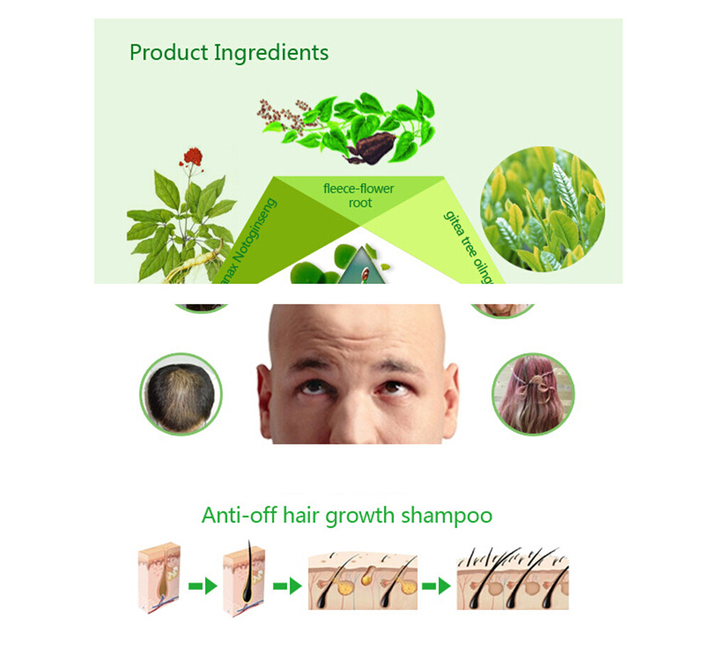 DEXE Anti-Hair Loss Shampoo Chinese Herbal Hair Regrowth For Men & Women 200ml