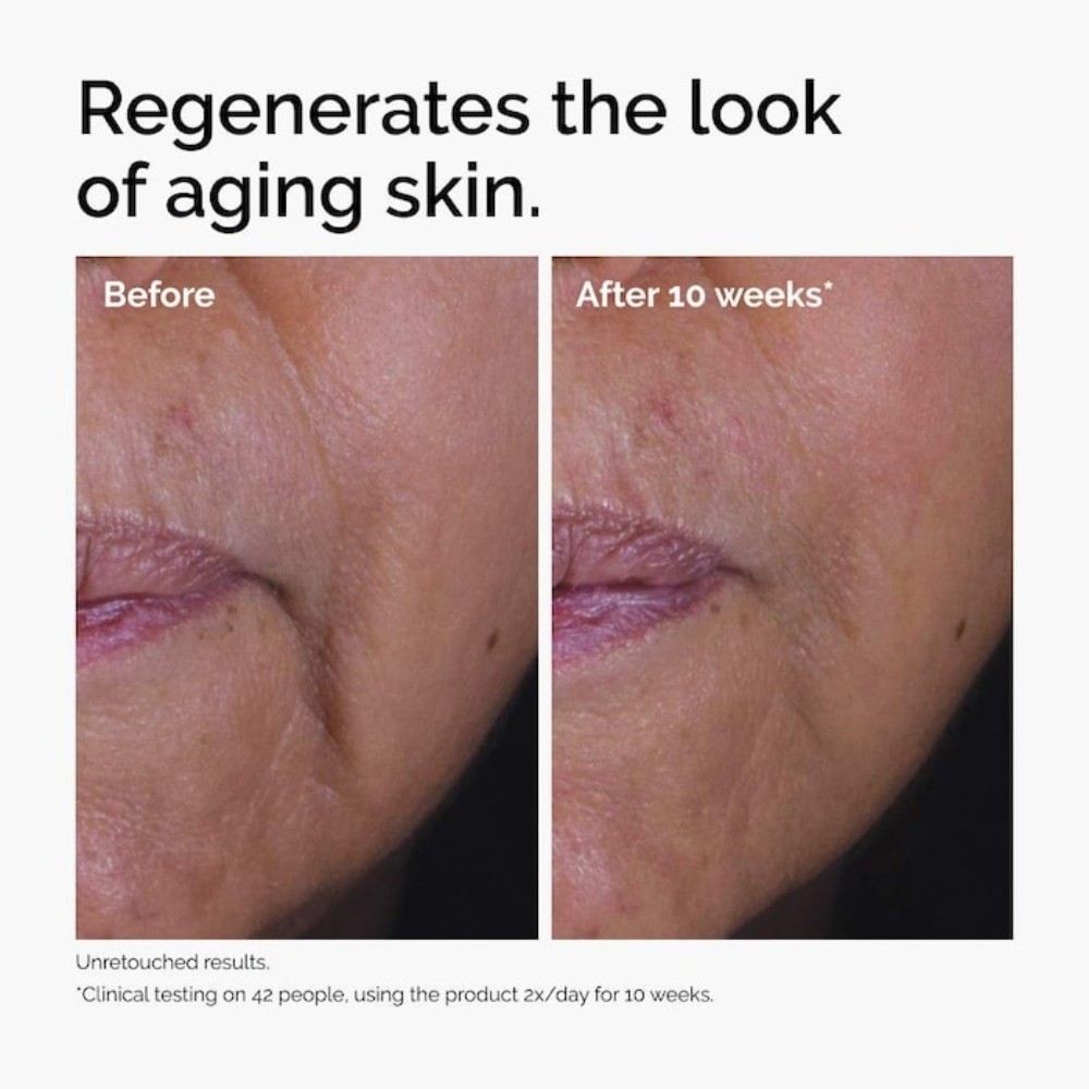 The Ordinary Authentic GF 15% Serum for Visible Skin Repair and Wrinkles 1 oz