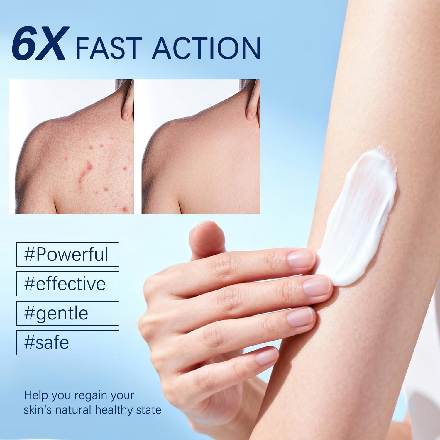 Folliculitis Cream 120g for Ingrown Hair Razor Bumps Skin Care
