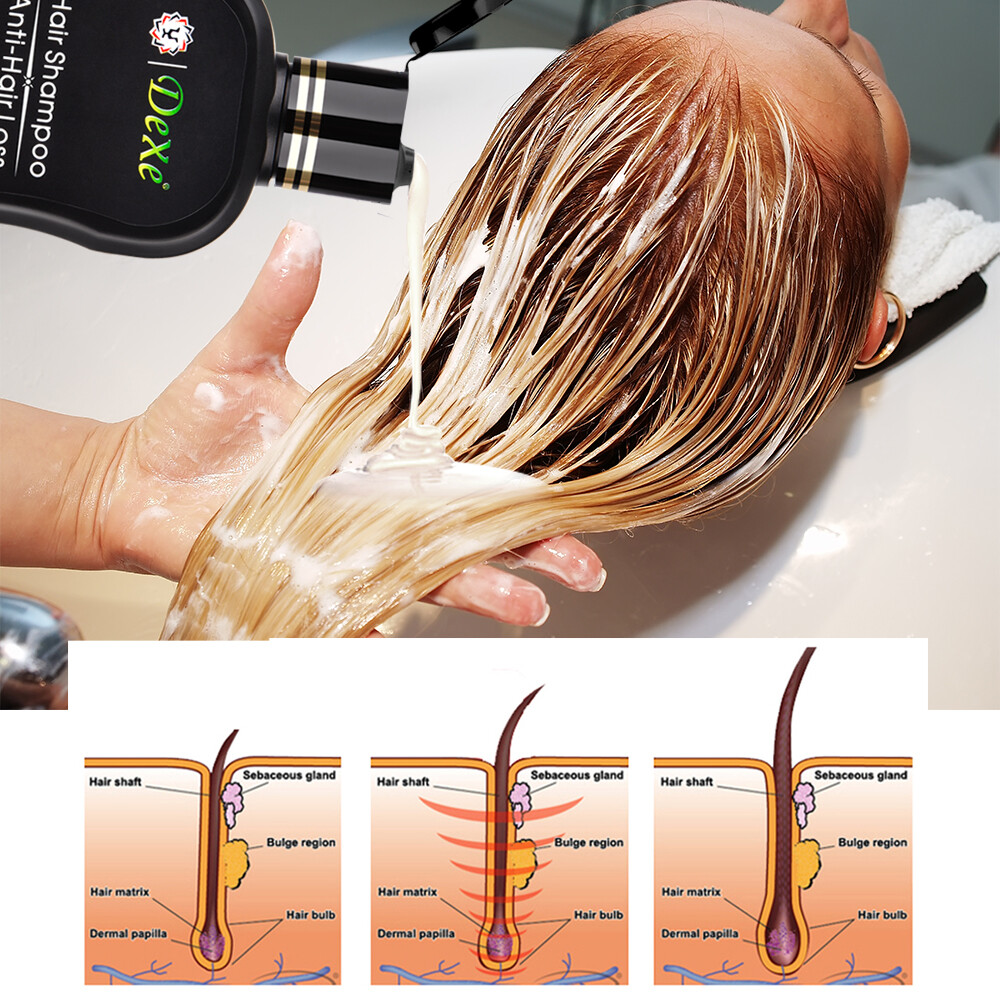 DEXE Anti-Hair Loss Shampoo Chinese Herbal Hair Regrowth For Men & Women 200ml