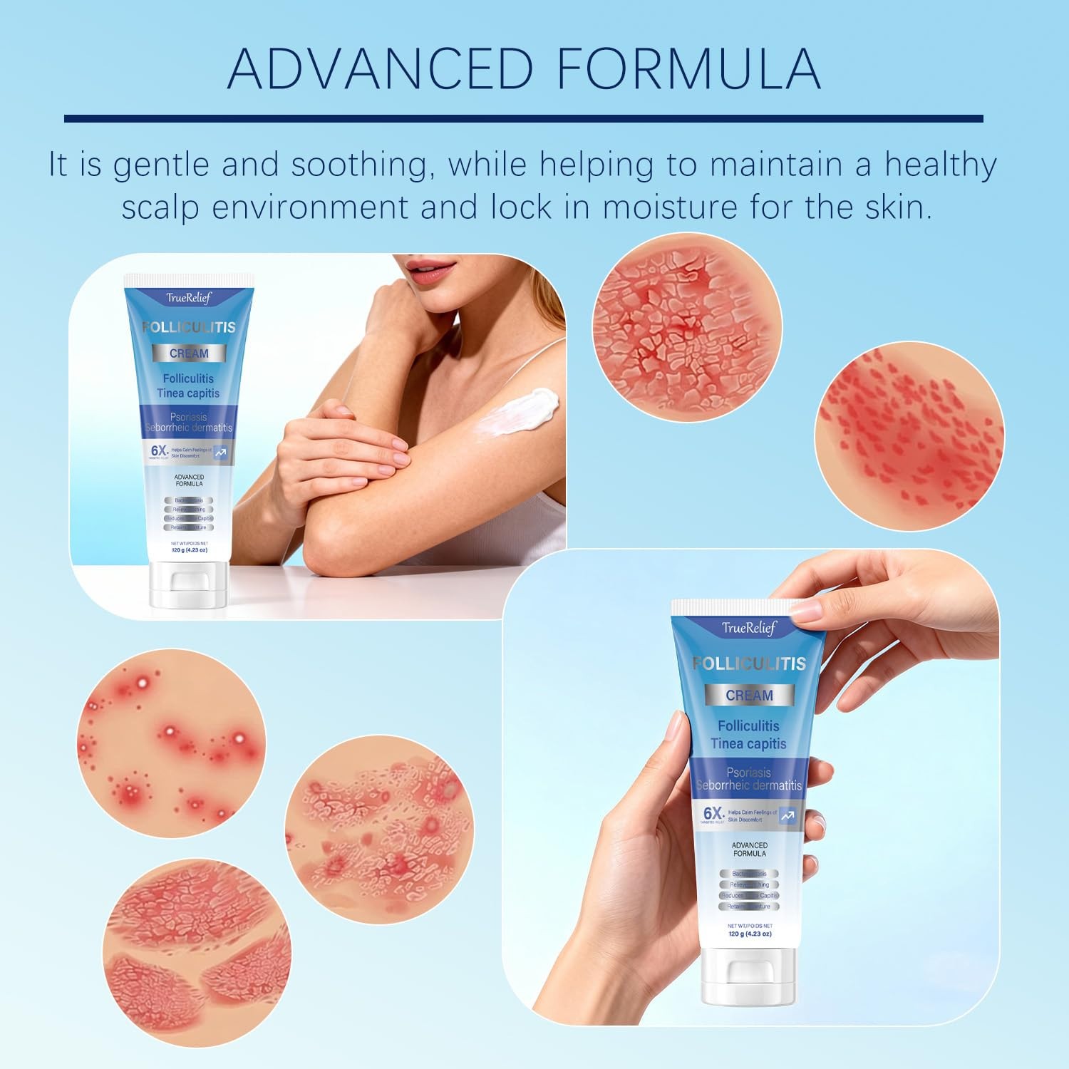 Folliculitis Cream 120g for Ingrown Hair Razor Bumps Skin Care