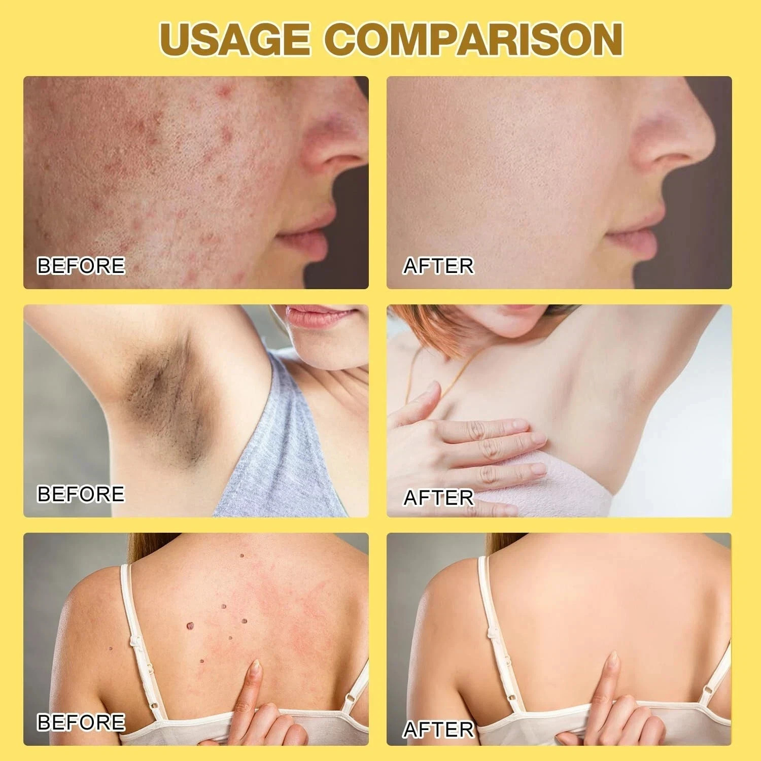 2Pcs Bee Venom Repair Creams, 2024 Professional Formula for Skin Treatment.