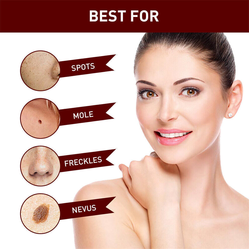 “FINAL SAL” Skin Tags & Moles Removal Quick Safe Remover Restore Skin 3ml US