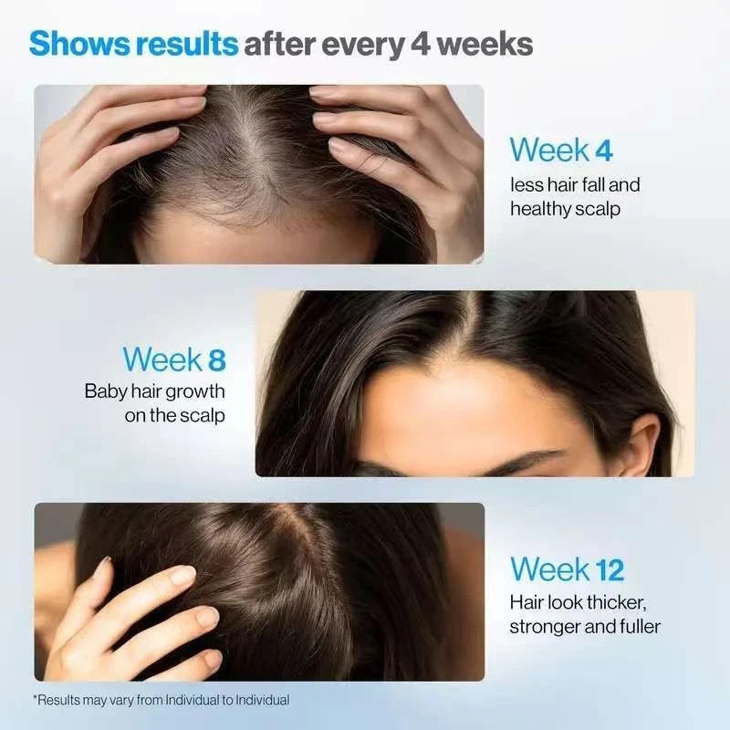 25ml Be Bodywise Hair Growth Serum Roll On – 3% Rosemary, 3% Redensyl & 2%