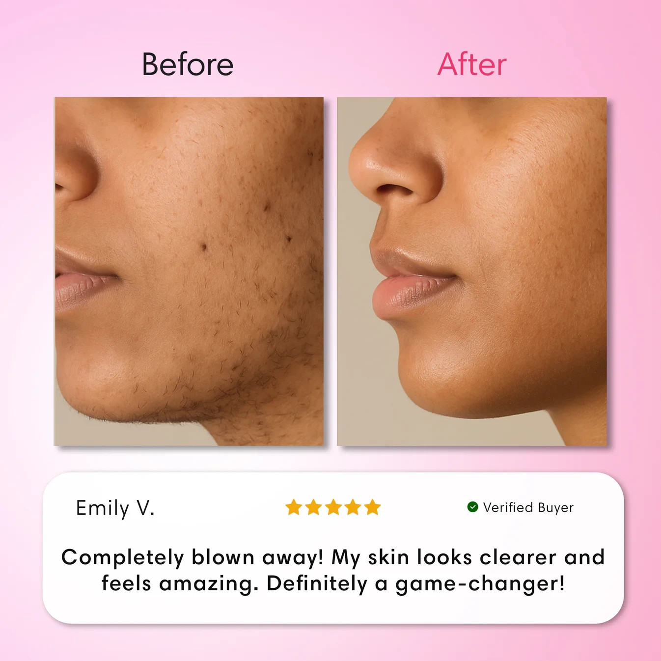 Auures Hair Removal Cream, Facial Cream Kit, Painless…