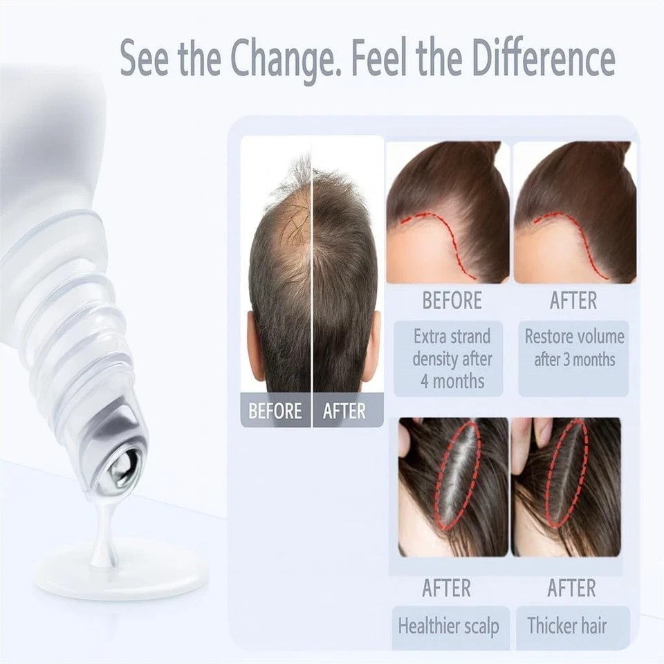 NEW Be Bodywise Hair Growth Serum Roll On – 3% Rosemary, 3% Redensyl & 2% – 25ml