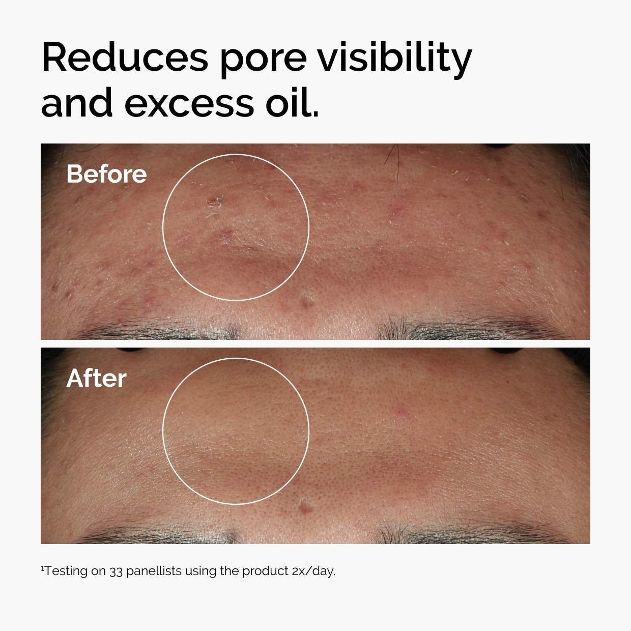 The Ordinary Authentic Niacinamide 10% + Zinc 1% Serum Standard Or Value