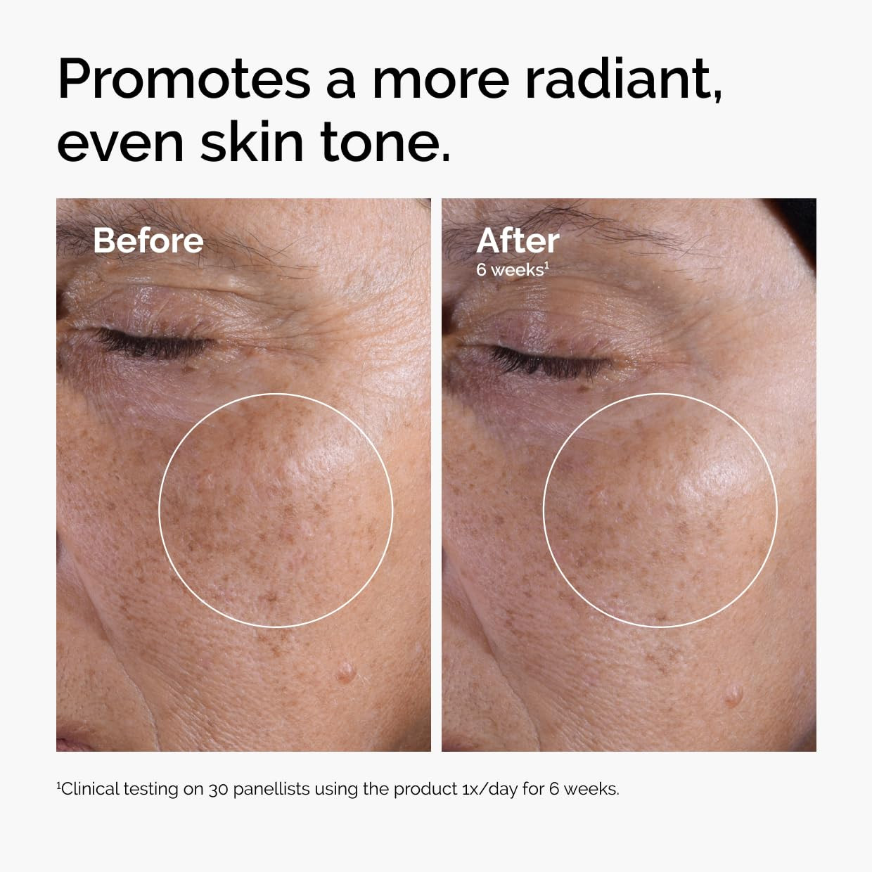 The Ordinary Glycolic Acid 7% Exfoliating Toner, Brightening and Smoothing Daily