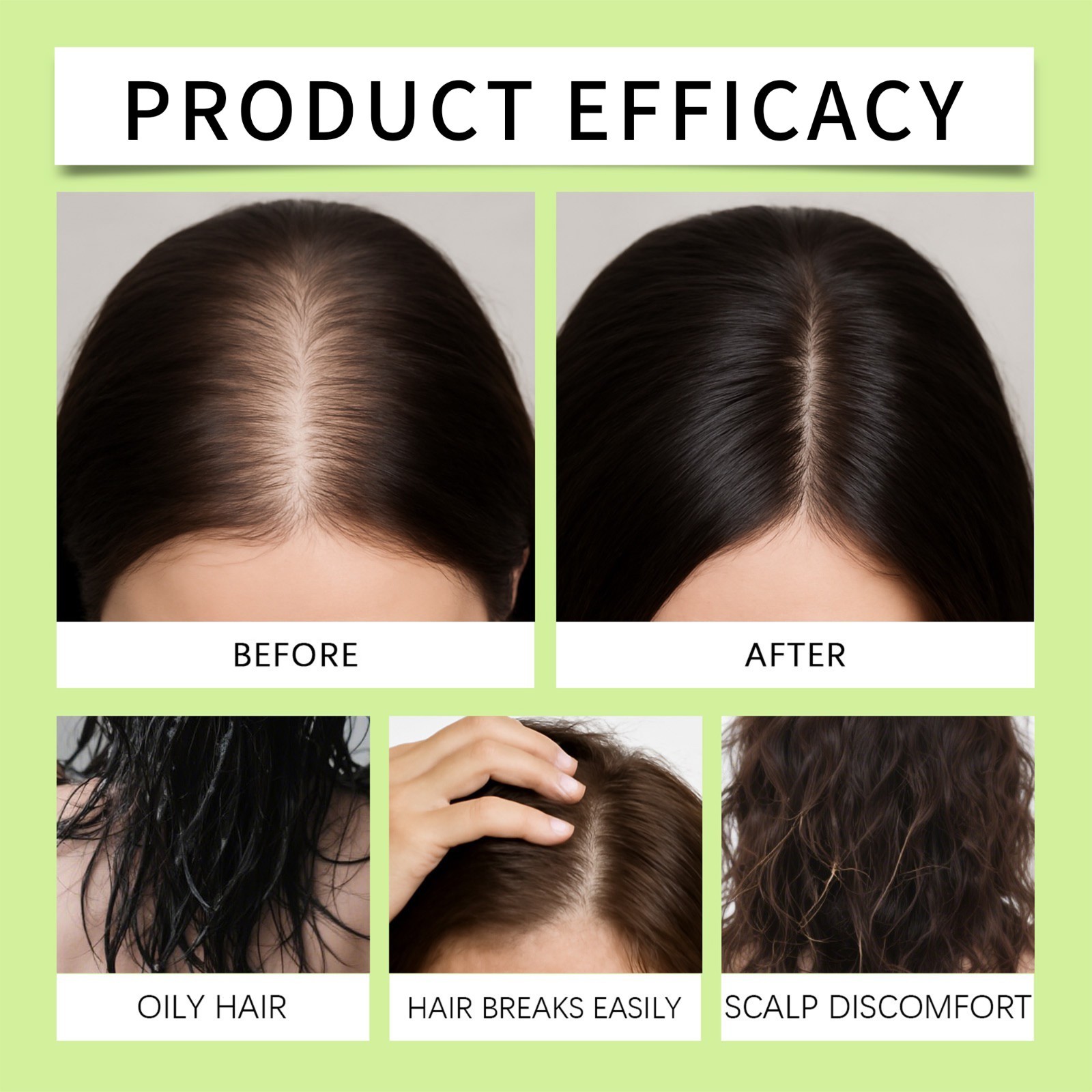 Thabet & KIN Hair Regrowth System, Advanced Hair Growth Treatment USA Brand FAST
