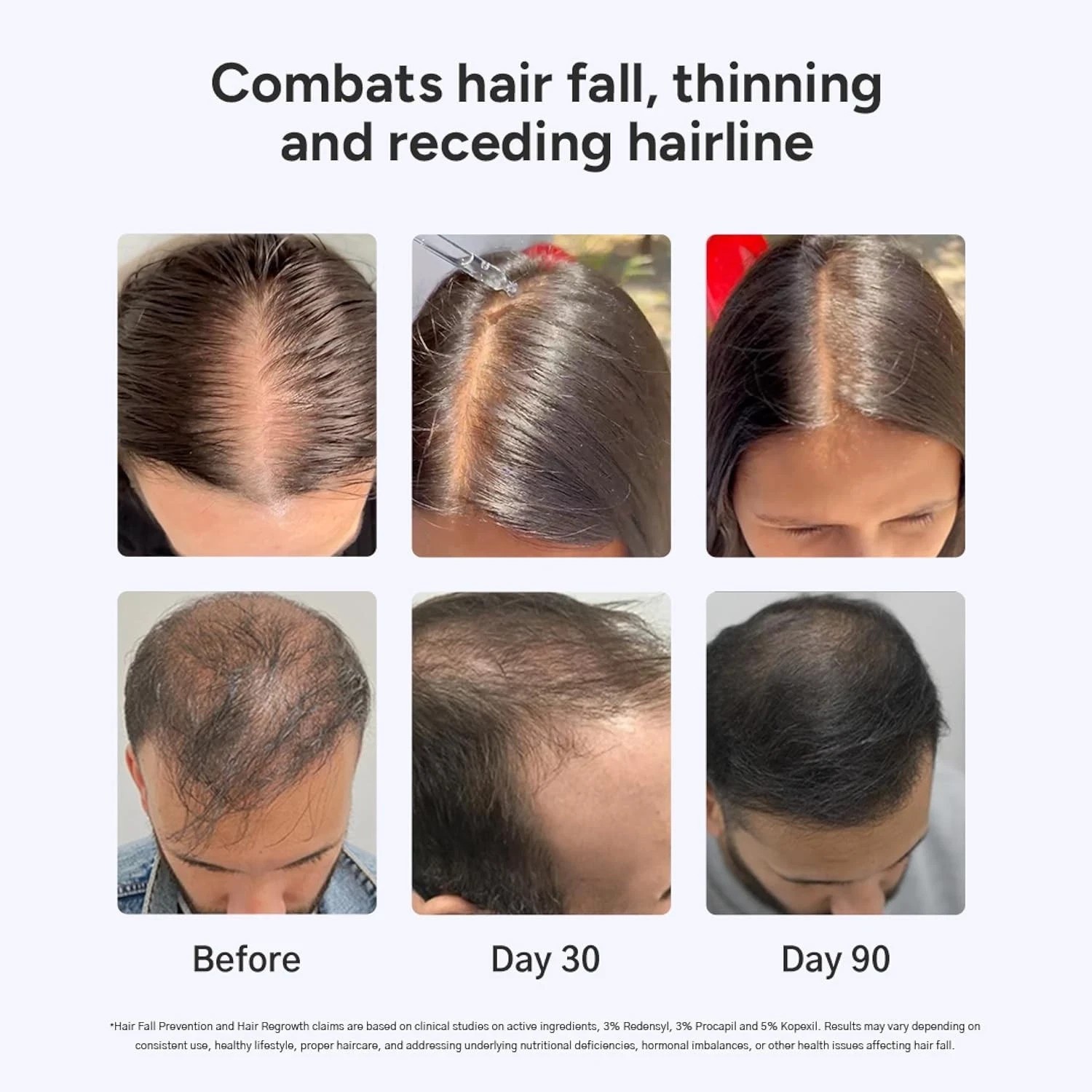 Arata Grow Strong Combo Intensive Hair Growth Serum & Super Shampoo 150ml + 30ml