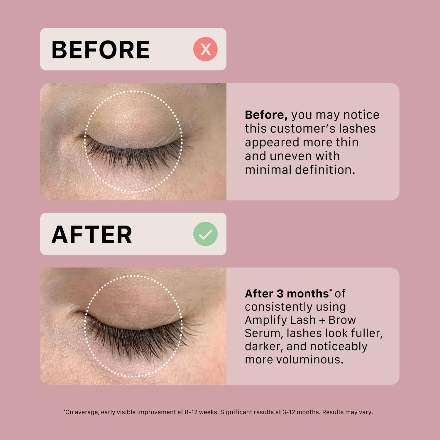 Actiiv Amplify Lash Brow Serum Promotes Thicker Fuller Lashes Brows Strengthens