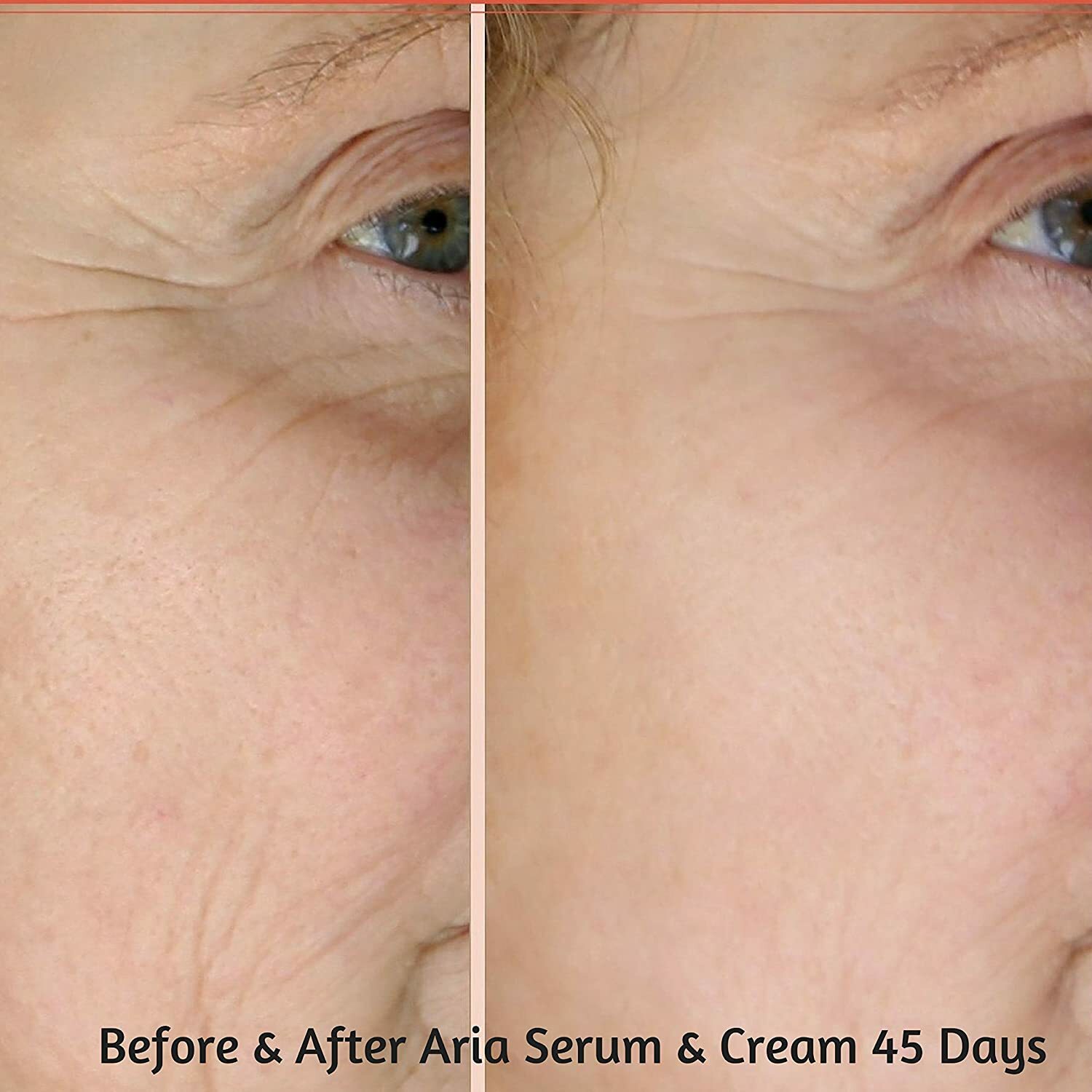 100% Pure Organic HYALURONIC ACID SERUM AntiAging Hydrating Wrinkle Filler Cream