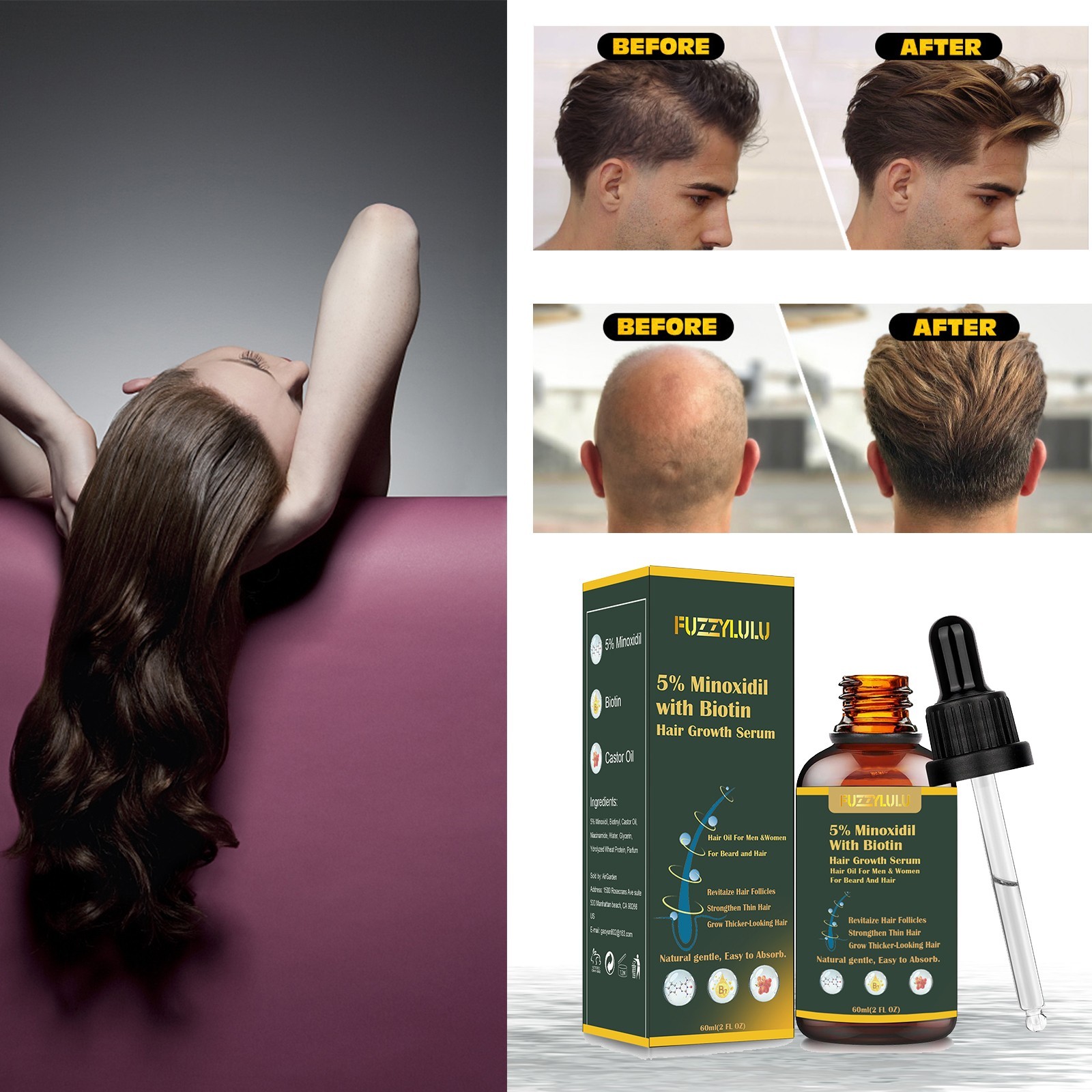 120ml 5% Minoxidil Biotin Hair Growth Serum for Healthier and Thicker Hair