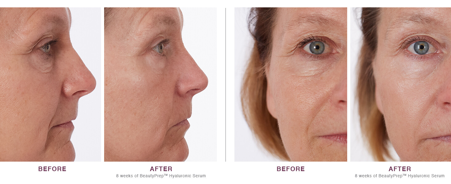 100% Pure Organic HYALURONIC ACID SERUM AntiAging Hydrating Wrinkle Filler Cream