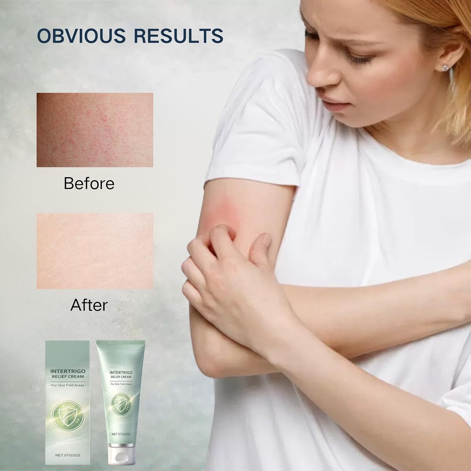 Soothe & Protect with 2-Pack Skin Fold Care Creams – Lightweight Formula