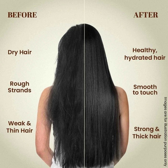 Zandu Ayurvedic Hair Growth Mask (200g) Promote Hair Growth & Reduce Hair Fall