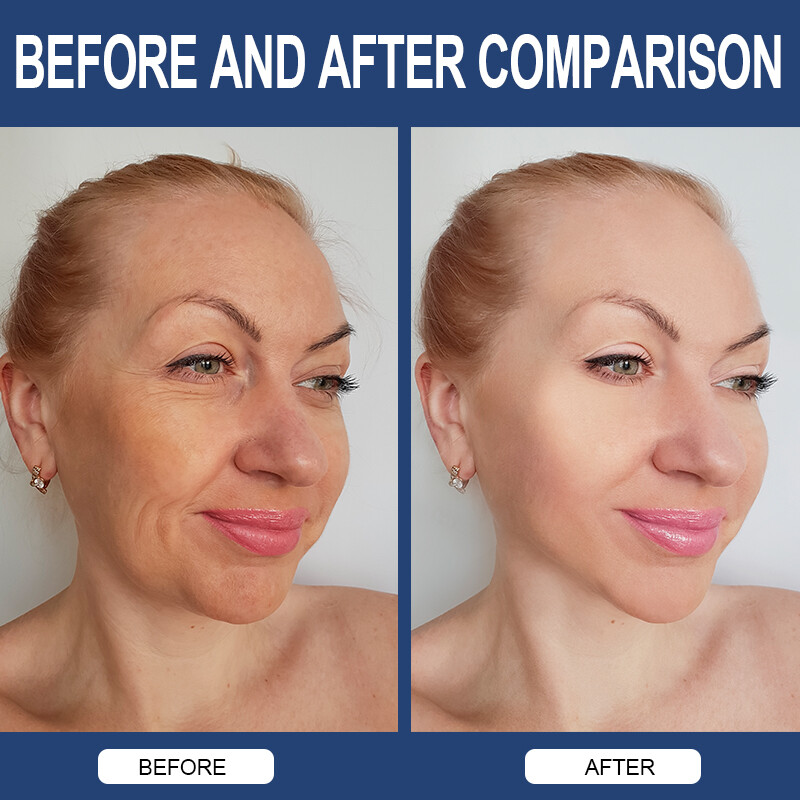 Hyaluronic Acid Anti Aging Hydrating Capsules Wrinkles Fine Lines Joint Health