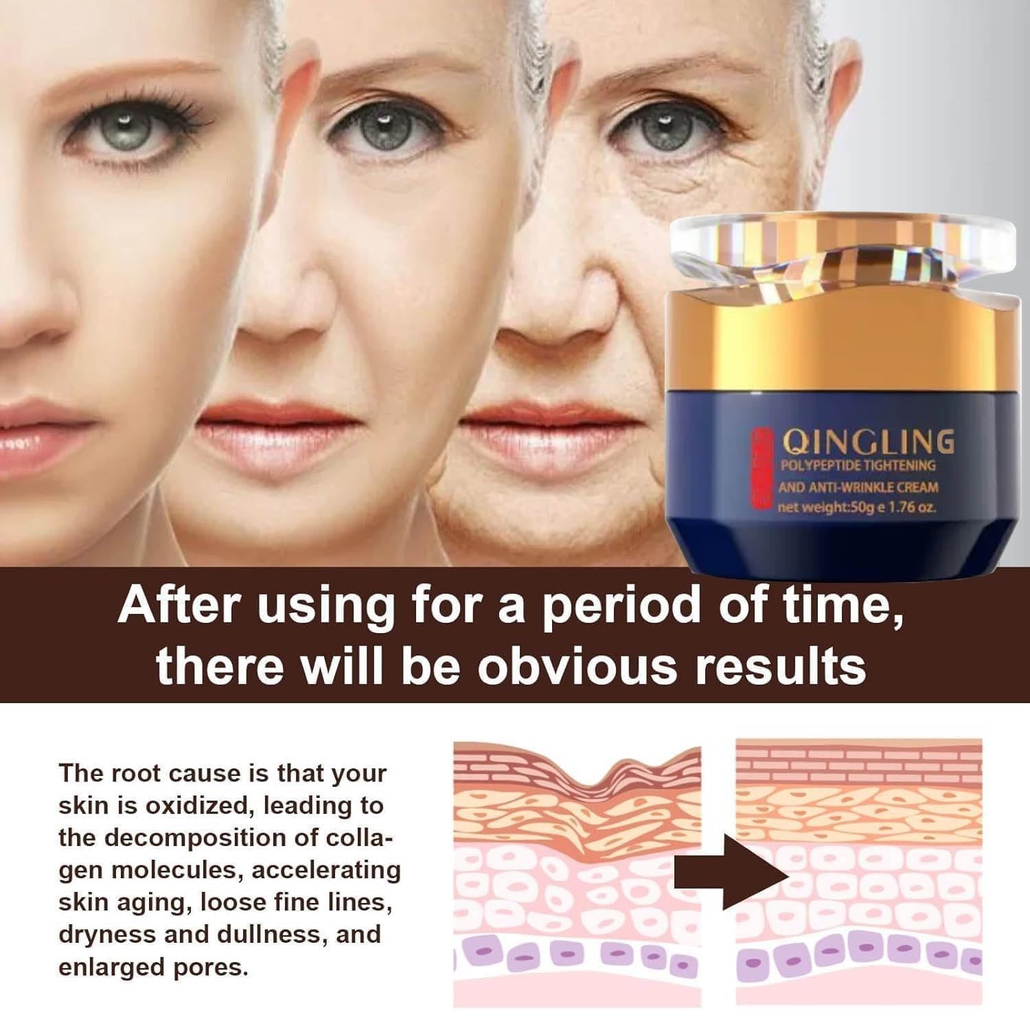 Qingling Face Cream, Quinglin Crema Para Arrugas, Qingling Wrinkle Removal Cream