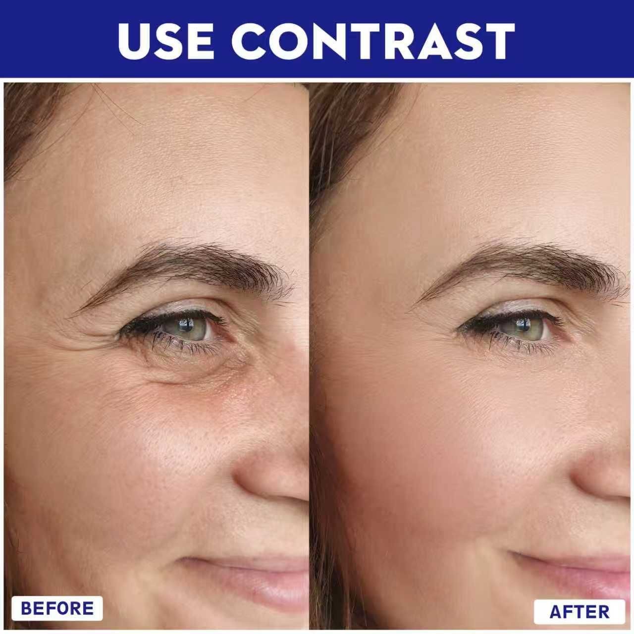 Anti Aging Micro Infusion System 0.05mm Microneedle Stamp Hyaluronic Acid Serum