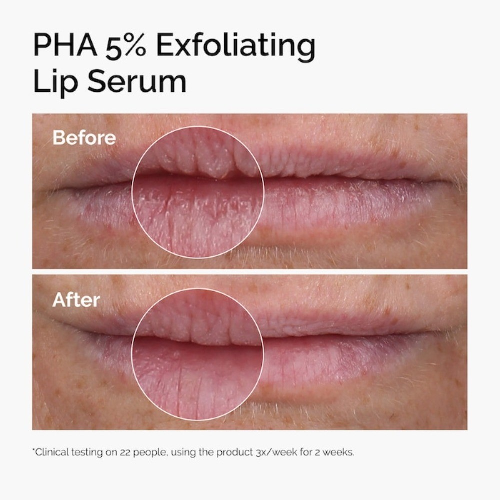 The Ordinary Authentic PHA 5% Exfoliating Lip Serum 0.5 oz/15 ml