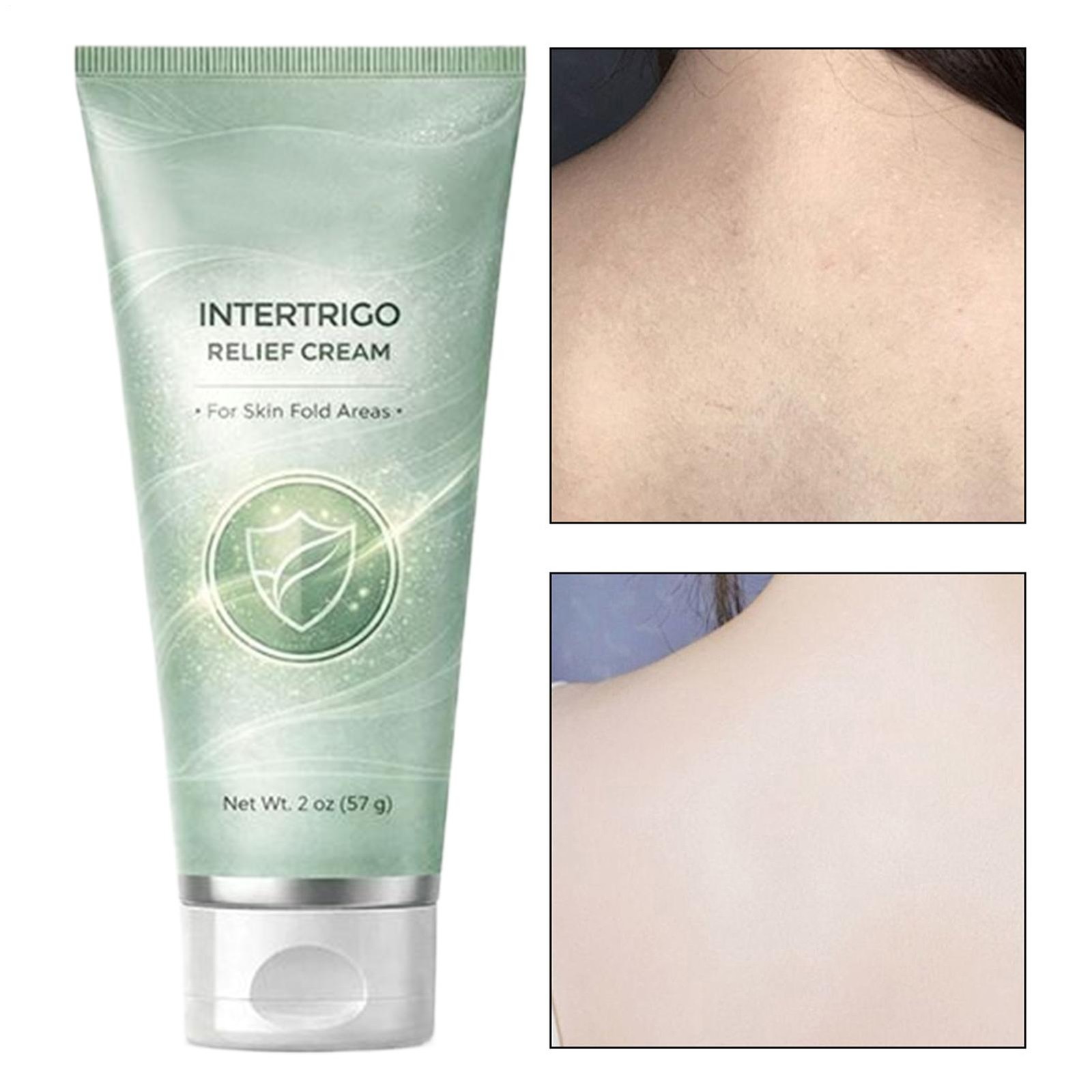Healora Intertrigo Cream – Skin Fold Care & Chafing Support Cream