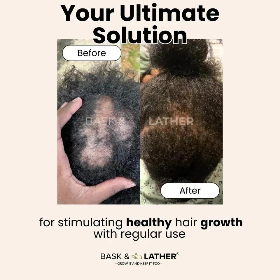 Bask Lather Scalp Stimulator Hair Growth Oil – Mint Rosemary – 2 fl oz (59 ml)