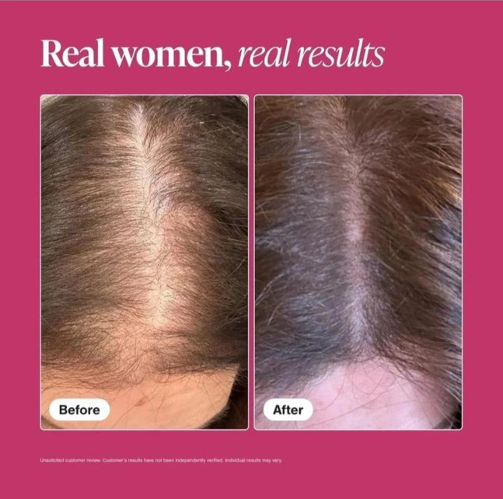 Viviscal Professional Hair Supplement Growth Tablets For Women 180 (Exp-07/2027)