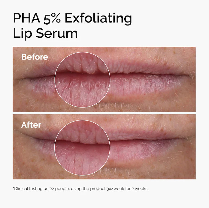 NIB 100% Authentic The Ordinary PHA 5% Exfoliating Lip Serum, 0.5 oz/15 ml