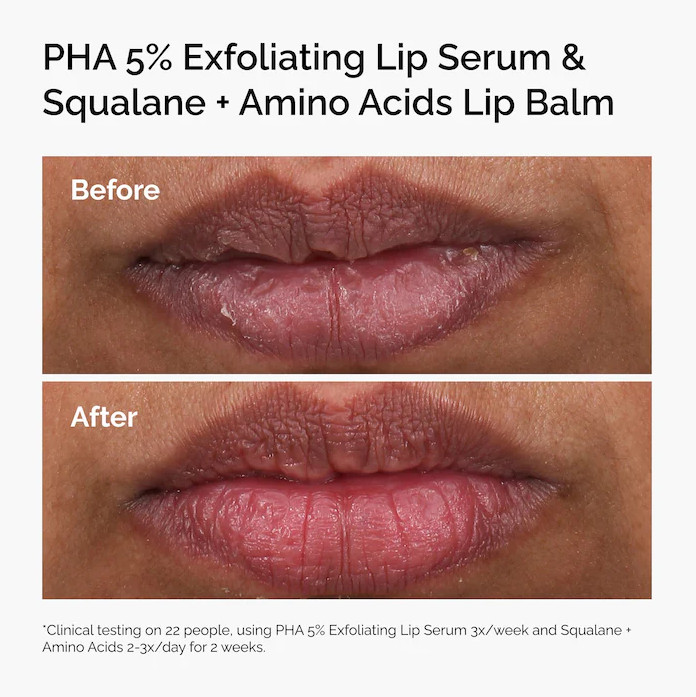 NIB 100% Authentic The Ordinary PHA 5% Exfoliating Lip Serum, 0.5 oz/15 ml