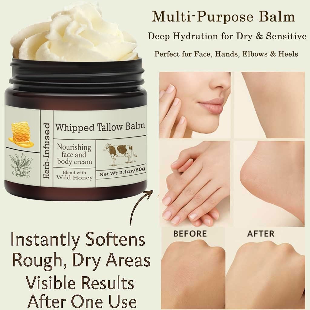 100% Grass-Fed Beef Tallow For Skin Balm with Organic Manuka Honey MGO 263+.