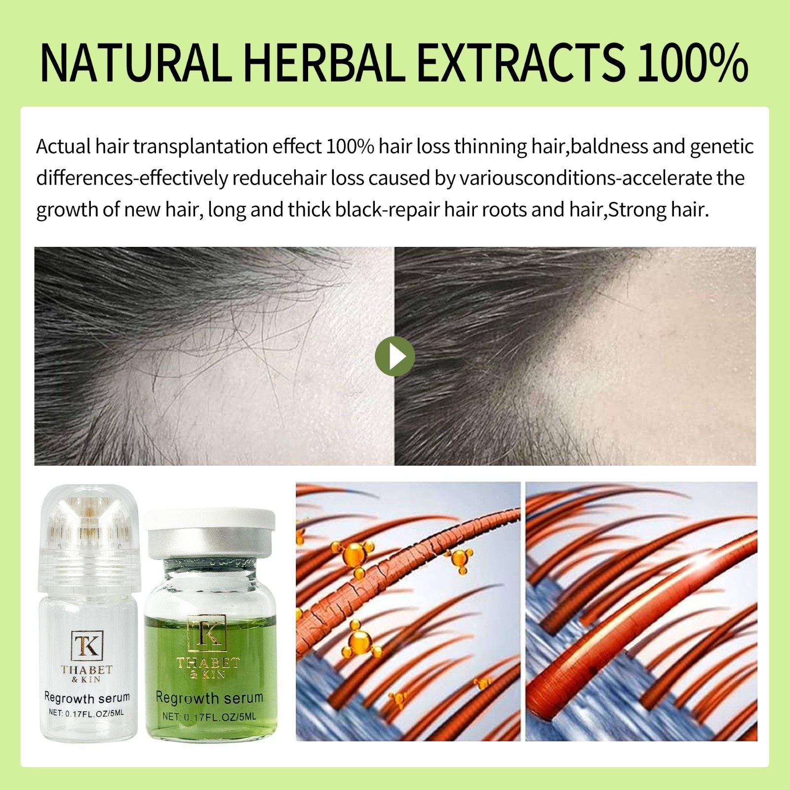 Thabet & KIN Hair Regrowth System, Advanced Hair Growth Treatment USA Brand FAST