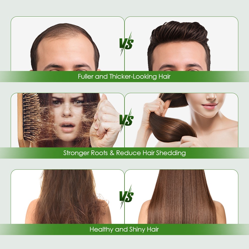 Hair Regrowth Combination System, Advanced Hair Growth Treatment US FAST Ship