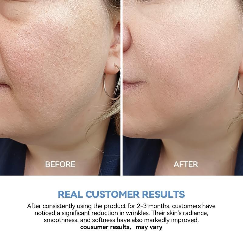 3% Hyaluronic Acid Serum-Anti-Aging & Hydrating, 30 PCS for Dry & Sensitive Skin