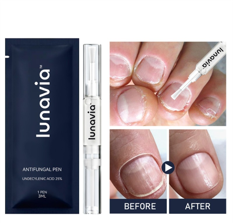 15 Pack Lunavia Antifungal Pen, 25% Undecylenic Acid – Toenail Fungus Treatment