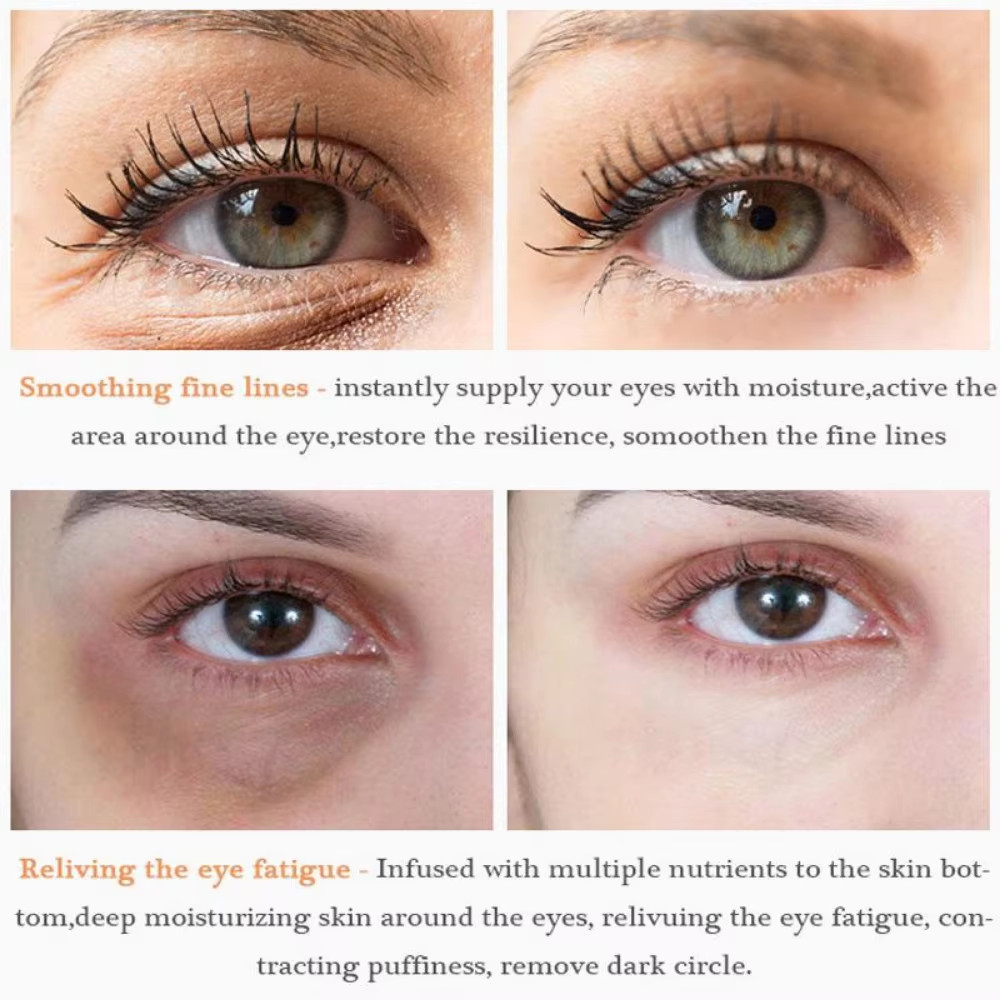 Retinol Eye Serum for Anti-Aging, Whitening, and Oil Control – Korean Formula
