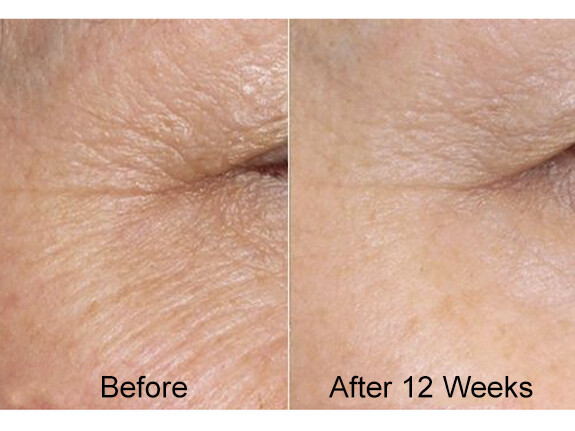 HYALURONIC ACID 100% Pure Anti Aging Hydrating Serum (Highest Strength – 2.5%)