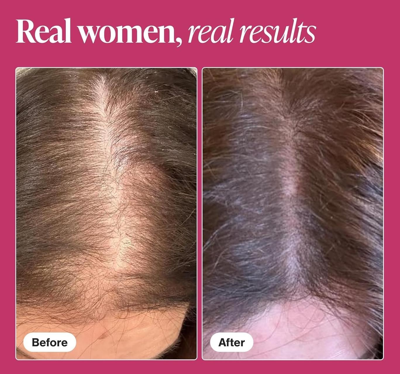 New VIVISCAL Hair Growth Supplement for Women 180 Tablets – 3 Month Supply