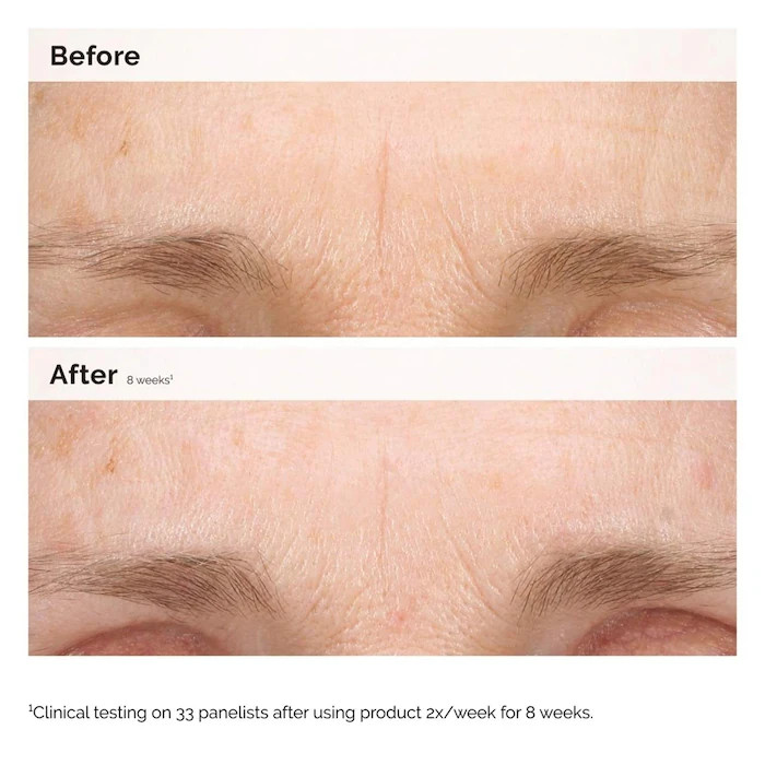 The Ordinary Authentic Retinal 0.2% Emulsion Nighttime Treatment 0.5 oz / 15 ml