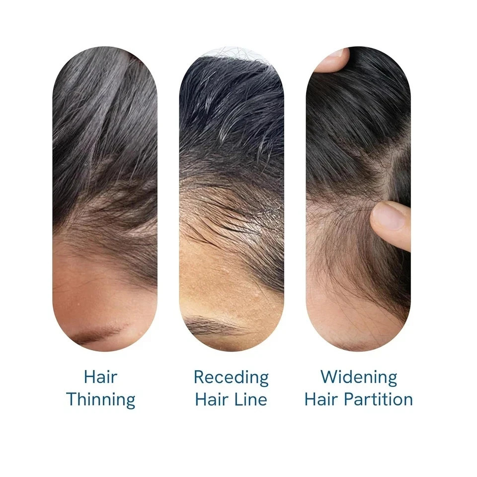Be Bodywise Hair Growth Serum Roll On – 3% Rosemary, 3% Redensyl & 2% – 25ml