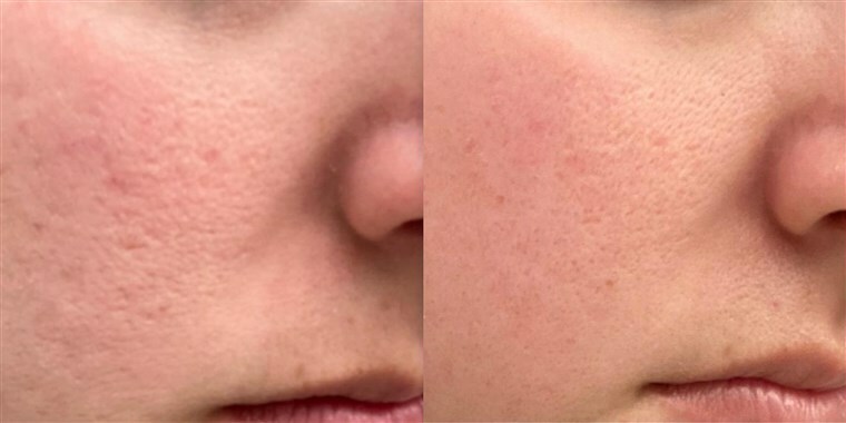 HYALURONIC ACID 100% Pure Anti Aging Hydrating Serum (Highest Strength – 2.5%)