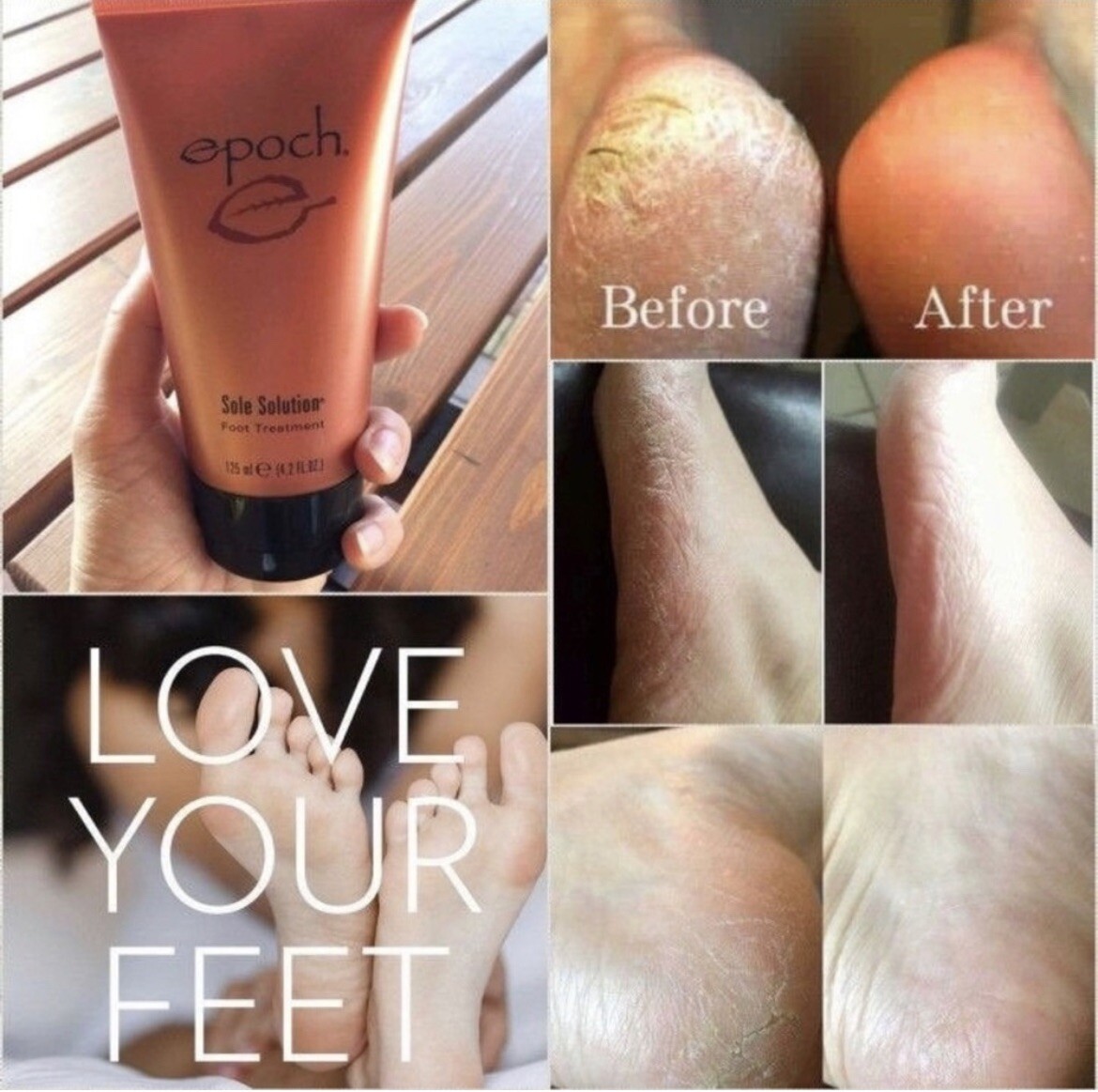 2 Packs – Nu Skin Epoch Nuskin Sole Solution Foot Treatment 4. fl oz new