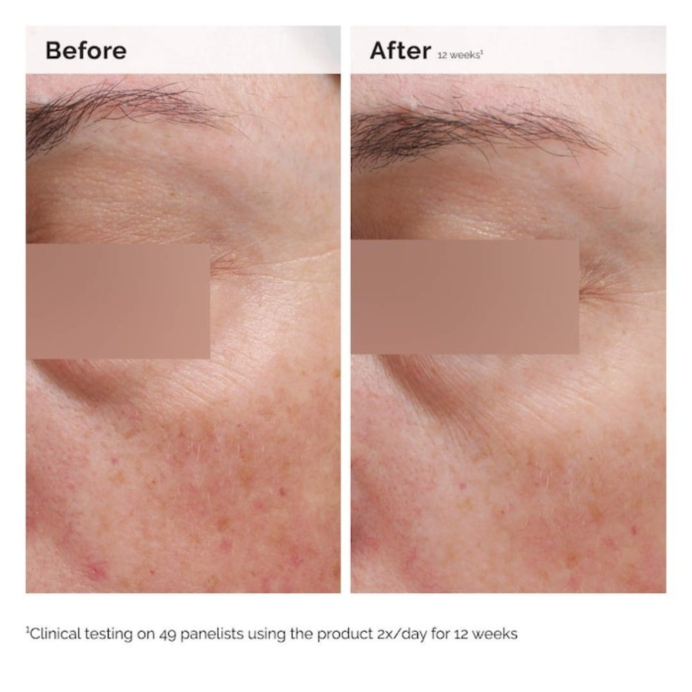 The Ordinary Authentic Niacinamide 5% Face and Body Emulsion 3.4 oz / 100 ml
