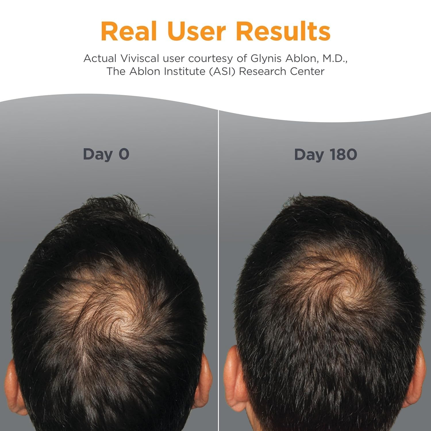 Viviscal Pro Professional Hair Growth Supplement 180 tablets For Men and Woman