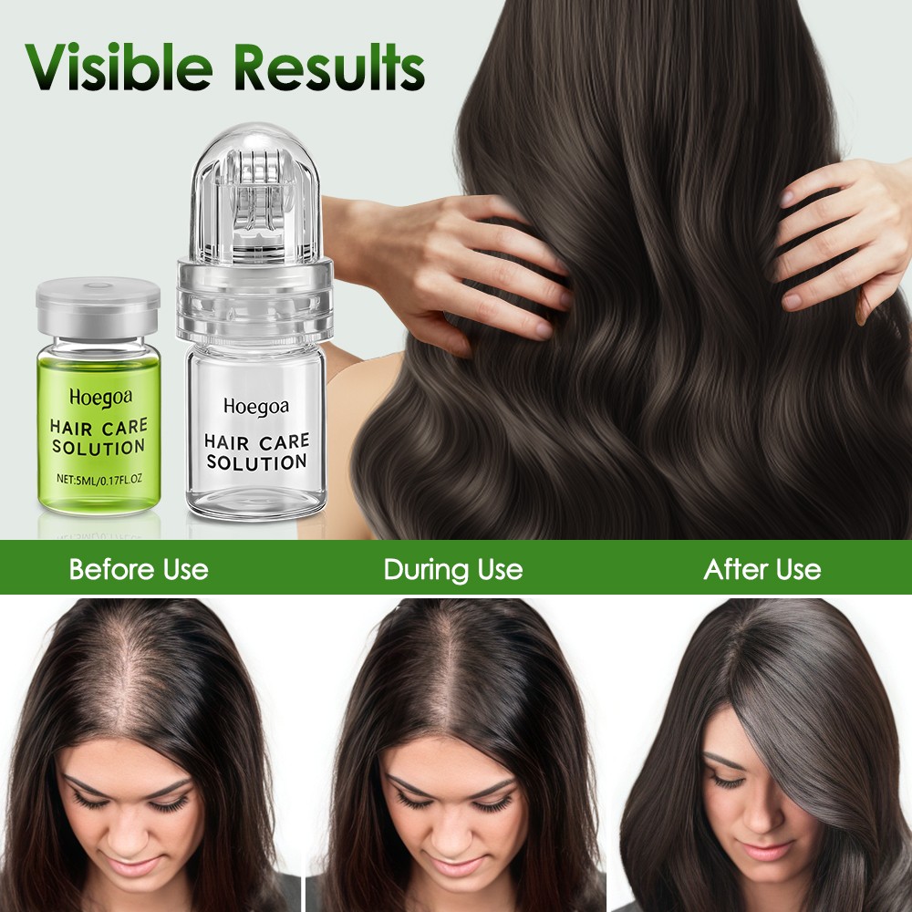 Hair Regrowth Combination System, Advanced Hair Growth Treatment US FAST Ship