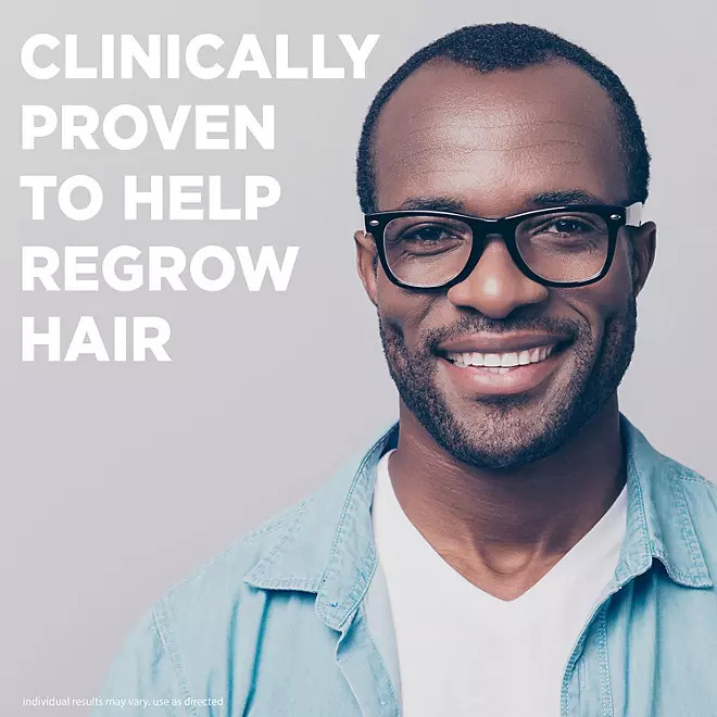 ✳️ Kirkland Minoxidil 5% Hair Regrowth Treatment AUTHENTIC Exp 03/2025✳️