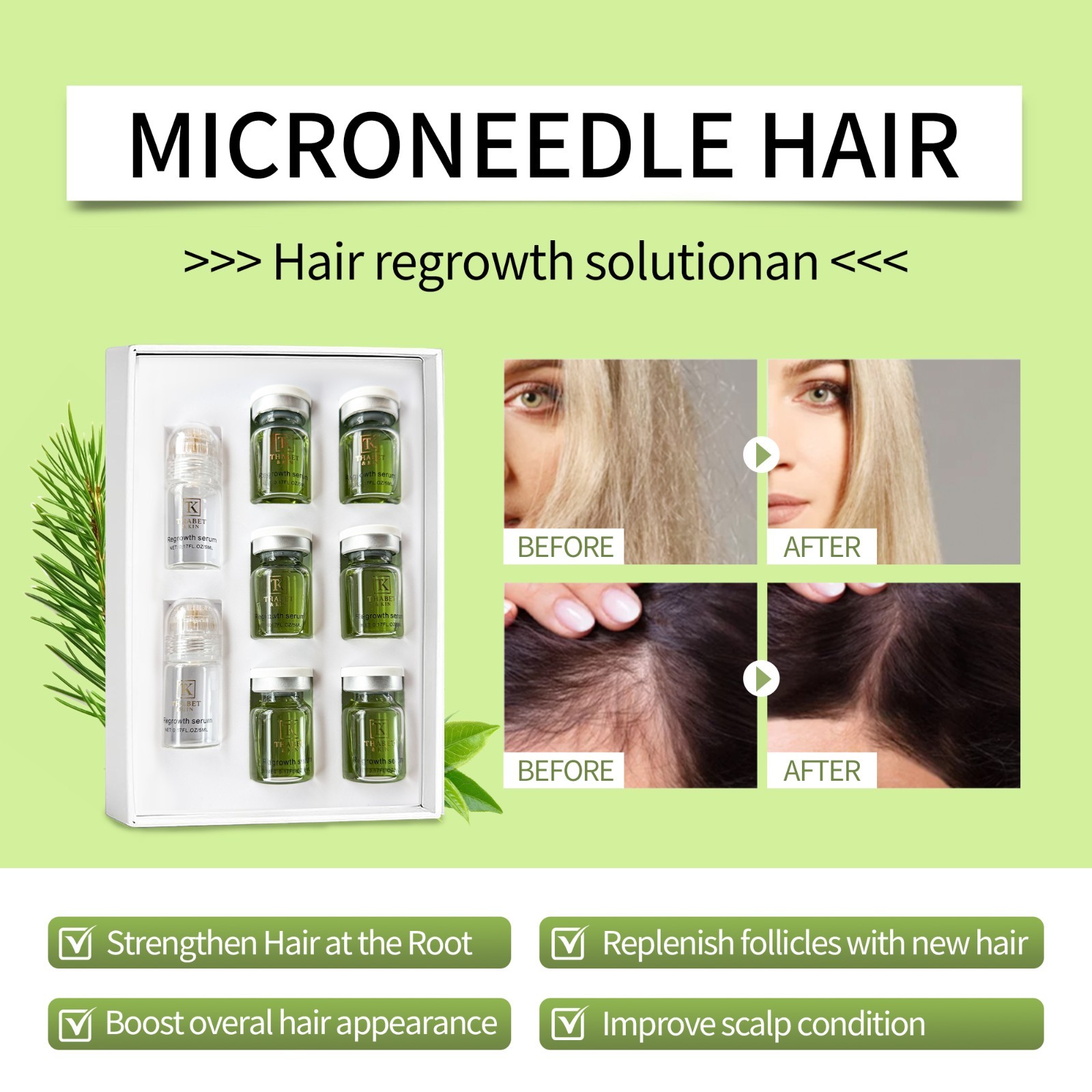 Thabet & KIN Hair Regrowth System, Advanced Hair Growth Treatment USA Brand FAST