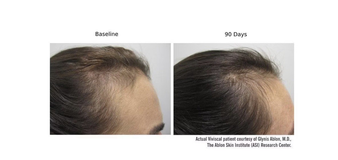 Viviscal Hair Growth Dietary Supplement with Collagen Complex 180